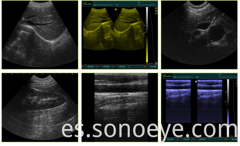 Portable Ultrasounder For Vet